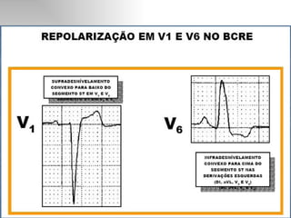 Ecg 5.0