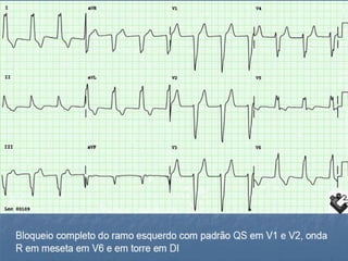 Ecg 5.0