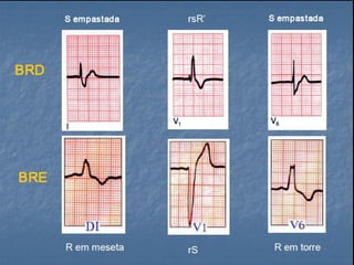 Ecg 5.0