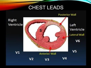 CHEST LEADS
 