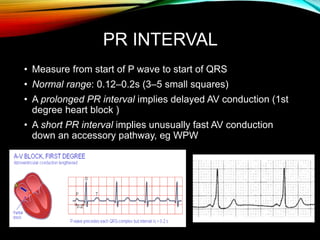PR INTERVAL
• Measure from start of P wave to start of QRS
• Normal range: 0.12–0.2s (3–5 small squares)
• A prolonged PR interval implies delayed AV conduction (1st
degree heart block )
• A short PR interval implies unusually fast AV conduction
down an accessory pathway, eg WPW
 