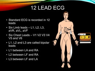12 LEAD ECG
• Standard ECG is recorded in 12
leads
• Six Limb leads – L1, L2, L3,
aVR, aVL, aVF
• Six Chest Leads – V1 V2 V3 V4
V5 and V6
• L1, L2 and L3 are called bipolar
leads
• L1 between LA and RA
• L2 between LF and RA
• L3 between LF and LA
 