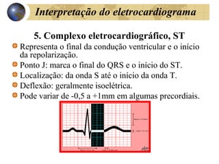 Interpretação do eletrocardiograma
5. Complexo eletrocardiográfico, ST
Representa o final da condução ventricular e o início
da repolarização.
Ponto J: marca o final do QRS e o início do ST.
Localização: da onda S até o início da onda T.
Deflexão: geralmente isoelétrica.
Pode variar de -0,5 a +1mm em algumas precordiais.
 