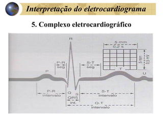 Interpretação do eletrocardiograma
5. Complexo eletrocardiográfico
 