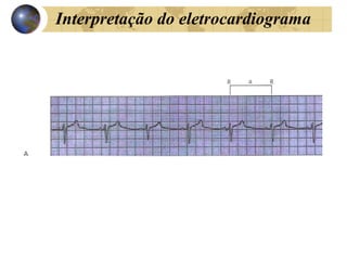 Interpretação do eletrocardiograma
 