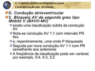 I- Critérios Eletrocardiográficos para
Caracterização das Arritmias
D. Condução atrioventricular
3. Bloqueio AV de segundo grau tipo
Mobitz II (BAVII-MII)
existe uma claudicação súbita da condução
AV
Nota-se condução AV 1:1 com intervalo PR
fixo
e, repentinamente, uma onda P bloqueada
Seguida por nova condução AV 1:1 com PR
semelhante aos anteriores
A freqüência da claudicação pode ser variável,
por exemplo, 5:4, 4:3, 3:2
 