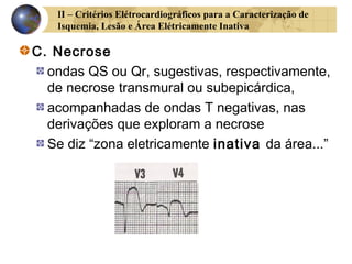 II – Critérios Elétrocardiográficos para a Caracterização de
Isquemia, Lesão e Área Elétricamente Inativa
C. Necrose
ondas QS ou Qr, sugestivas, respectivamente,
de necrose transmural ou subepicárdica,
acompanhadas de ondas T negativas, nas
derivações que exploram a necrose
Se diz “zona eletricamente inativa da área...”
 