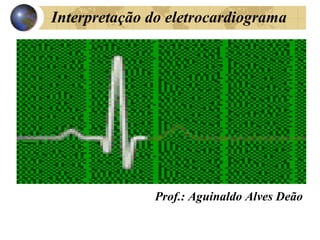 Interpretação do eletrocardiograma
Prof.: Aguinaldo Alves Deão
 
