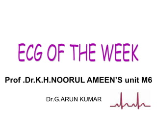 Prof .Dr.K.H.NOORUL AMEEN’S unit M6 Dr.G.ARUN KUMAR ECG OF THE WEEK 