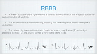 ECG Abnormalities in Pulmonary Medicine | PPTX