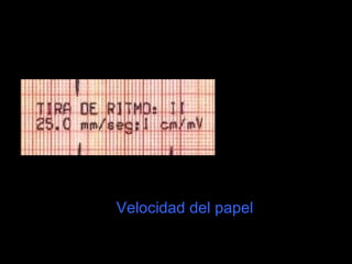 Velocidad del papel
 