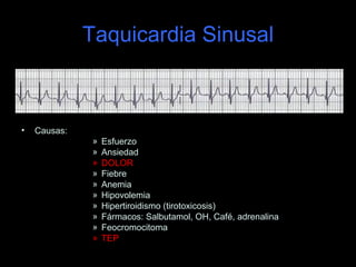 Taquicardia Sinusal



•   Causas:
               »   Esfuerzo
               »   Ansiedad
               »   DOLOR
               »   Fiebre
               »   Anemia
               »   Hipovolemia
               »   Hipertiroidismo (tirotoxicosis)
               »   Fármacos: Salbutamol, OH, Café, adrenalina
               »   Feocromocitoma
               »   TEP
 