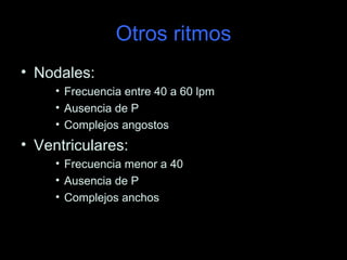 Otros ritmos
• Nodales:
     • Frecuencia entre 40 a 60 lpm
     • Ausencia de P
     • Complejos angostos
• Ventriculares:
     • Frecuencia menor a 40
     • Ausencia de P
     • Complejos anchos
 
