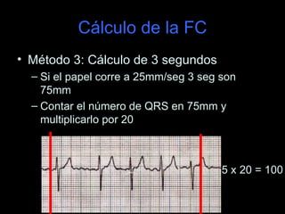Cálculo de la FC
• Método 3: Cálculo de 3 segundos
  – Si el papel corre a 25mm/seg 3 seg son
    75mm
  – Contar el número de QRS en 75mm y
    multiplicarlo por 20



                                       5 x 20 = 100
 