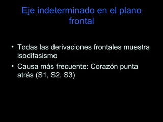 Eje indeterminado en el plano
               frontal

• Todas las derivaciones frontales muestra
  isodifasismo
• Causa más frecuente: Corazón punta
  atrás (S1, S2, S3)
 