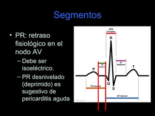 Segmentos

• PR: retraso
  fisiológico en el
  nodo AV
  – Debe ser
    isoeléctrico.
  – PR desnivelado
    (deprimido) es
    sugestivo de
    pericarditis aguda
 