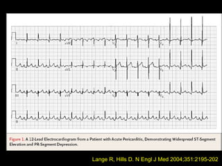 Lange R, Hills D. N Engl J Med 2004;351:2195-202
 