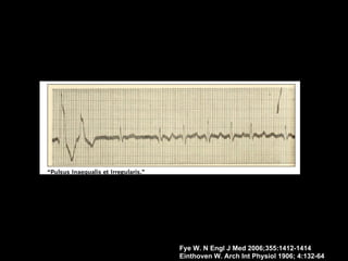 Fye W. N Engl J Med 2006;355:1412-1414
Einthoven W. Arch Int Physiol 1906; 4:132-64
 