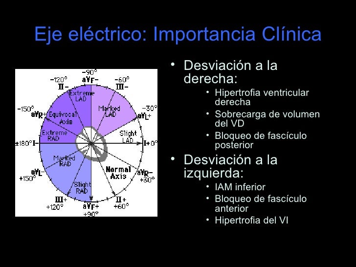 Bases de la interpretación del ECG