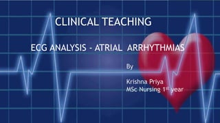 ECG ANALYSIS - ATRIAL ARRHYTHMIAS
CLINICAL TEACHING
By
Krishna Priya
MSc Nursing 1st year
 