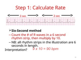 nursing cardiology ECG AND DYSRHYTHMIAS.ppt
