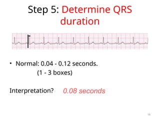 nursing cardiology ECG AND DYSRHYTHMIAS.ppt