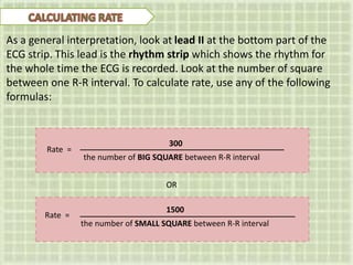 300
the number of BIG SQUARE between R-R interval
Rate =
As a general interpretation, look at lead II at the bottom part of the
ECG strip. This lead is the rhythm strip which shows the rhythm for
the whole time the ECG is recorded. Look at the number of square
between one R-R interval. To calculate rate, use any of the following
formulas:
1500
the number of SMALL SQUARE between R-R interval
OR
Rate =
 
