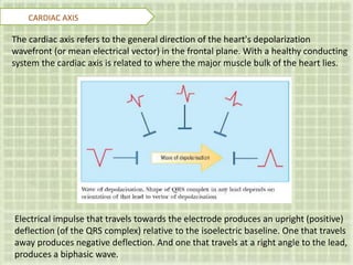 CARDIAC AXIS
Electrical impulse that travels towards the electrode produces an upright (positive)
deflection (of the QRS complex) relative to the isoelectric baseline. One that travels
away produces negative deflection. And one that travels at a right angle to the lead,
produces a biphasic wave.
The cardiac axis refers to the general direction of the heart's depolarization
wavefront (or mean electrical vector) in the frontal plane. With a healthy conducting
system the cardiac axis is related to where the major muscle bulk of the heart lies.
 