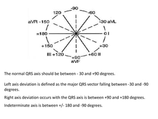 The normal QRS axis should be between - 30 and +90 degrees.
Left axis deviation is defined as the major QRS vector falling between -30 and -90
degrees.
Right axis deviation occurs with the QRS axis is between +90 and +180 degrees.
Indeterminate axis is between +/- 180 and -90 degrees.
 