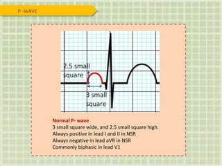 Normal P- wave
3 small square wide, and 2.5 small square high.
Always positive in lead I and II in NSR
Always negative in lead aVR in NSR
Commonly biphasic in lead V1
P -WAVE
 