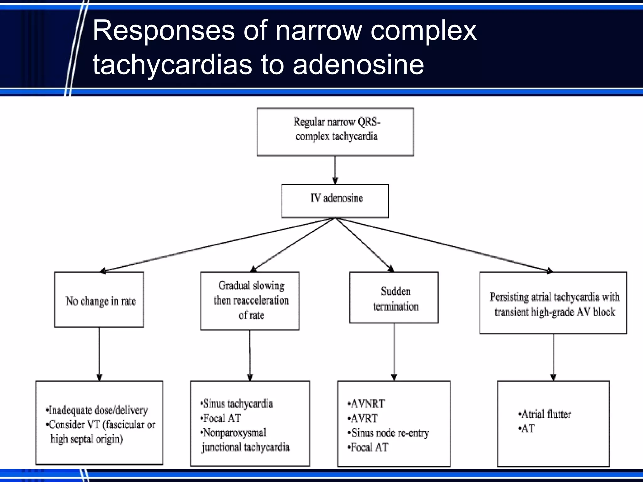 Responses of narrow complex
tachycardias to adenosine
 