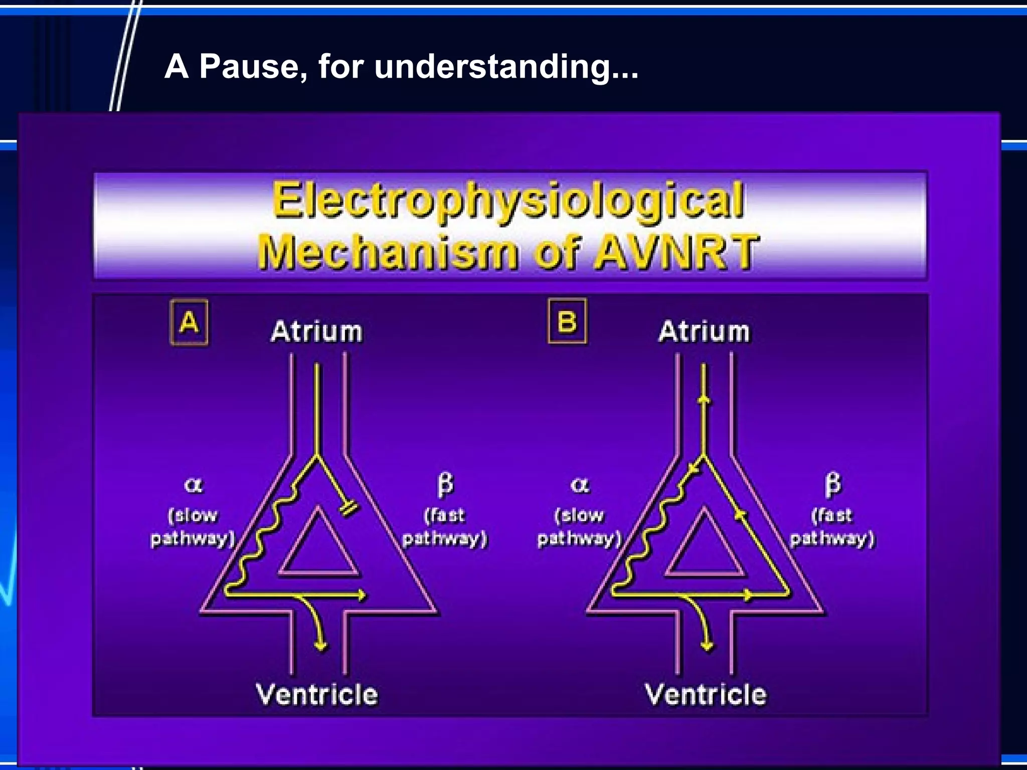 A Pause, for understanding...
 