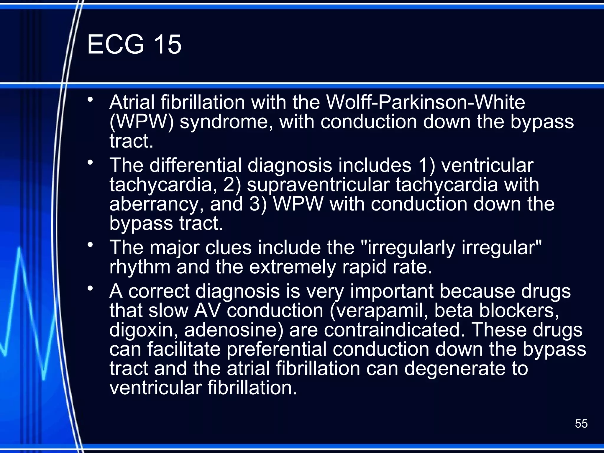 ECG 15
• Atrial fibrillation with the Wolff-Parkinson-White
(WPW) syndrome, with conduction down the bypass
tract.
• The differential diagnosis includes 1) ventricular
tachycardia, 2) supraventricular tachycardia with
aberrancy, and 3) WPW with conduction down the
bypass tract.
• The major clues include the "irregularly irregular"
rhythm and the extremely rapid rate.
• A correct diagnosis is very important because drugs
that slow AV conduction (verapamil, beta blockers,
digoxin, adenosine) are contraindicated. These drugs
can facilitate preferential conduction down the bypass
tract and the atrial fibrillation can degenerate to
ventricular fibrillation.
55
 