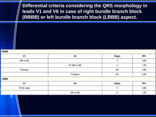 ECG approach to arrhythmias 2017 | PPT