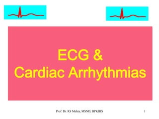 ECG &
Cardiac Arrhythmias
1Prof. Dr. RS Mehta, MSND, BPKIHS
 