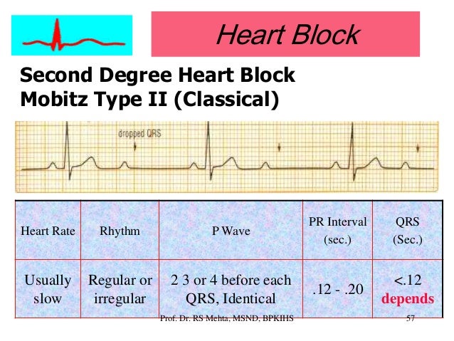 Heart regular rate rhythm