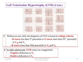 Ecg as an aid for diagnoses | PPTX