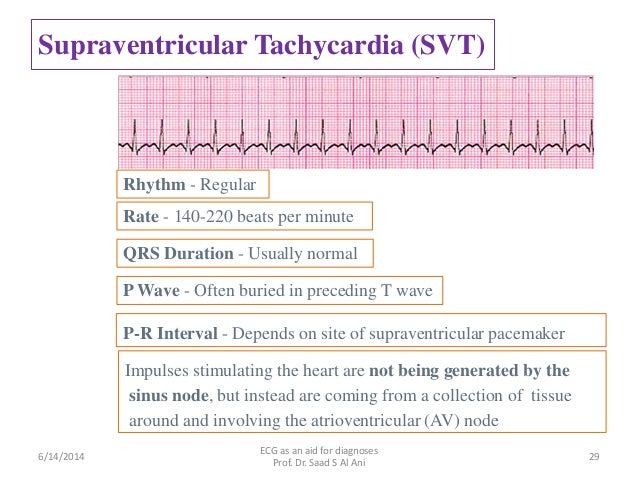 Heart regular rate rhythm