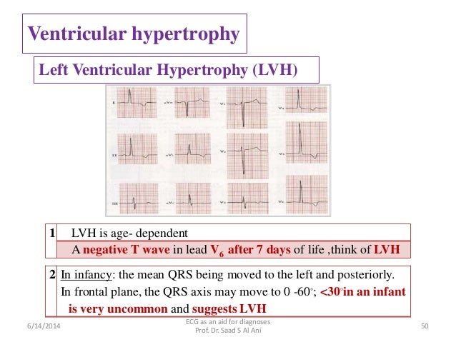 Ecg As An Aid For Diagnoses