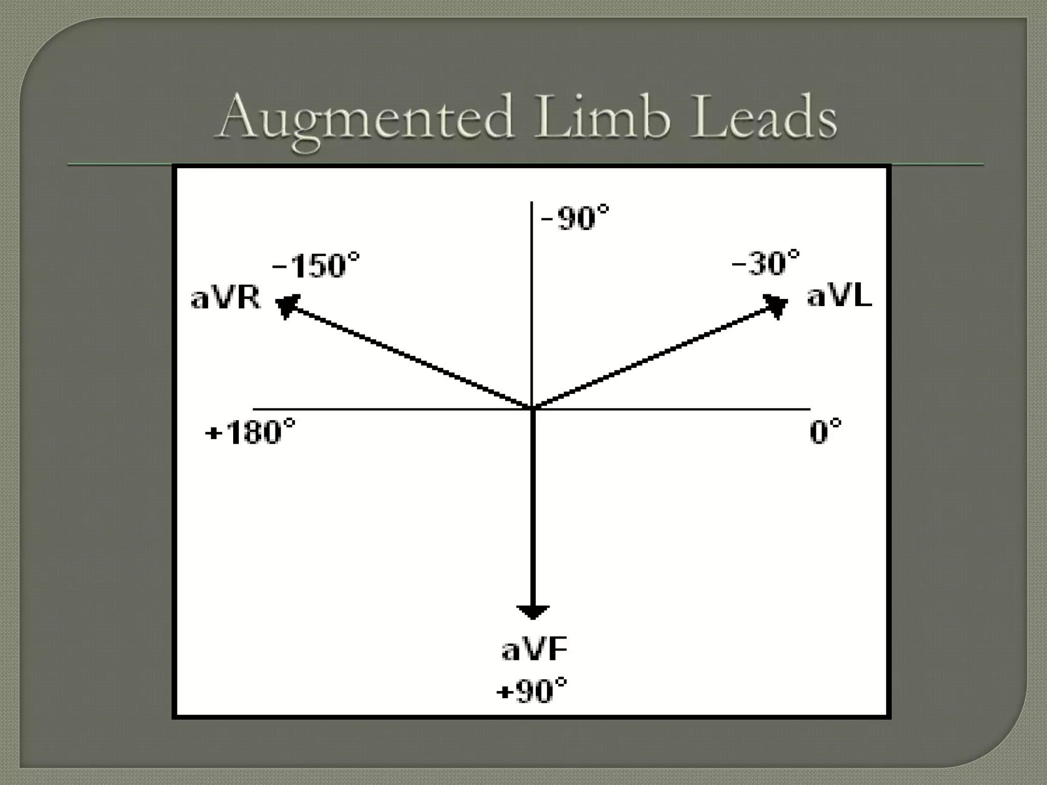 Ecg assessment of ihd | PPTX | Heart and Cardiovascular Diseases ...