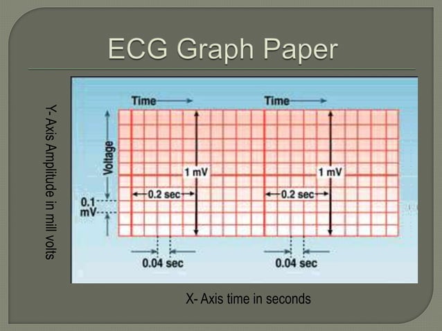 Ecg assessment of ihd | PPTX | Heart and Cardiovascular Diseases ...