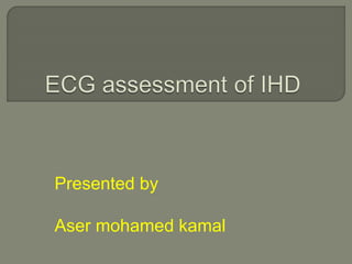 Ecg assessment of ihd