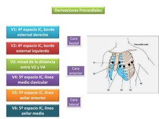 Derivaciones Precordiales
V1: 4º espacio IC, borde
esternal derecho
V2: 4º espacio IC, borde
esternal izquierdo
V3: mitad de la distancia
entre V2 y V4
V4: 5º espacio IC, línea
medio clavicular
V5: 5º espacio IC, línea
axilar anterior
V6: 5º espacio IC, línea
axilar media
Cara
Septal
Cara
anterior
Cara
lateral
 