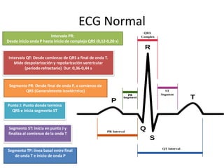ECG Normal
Intervalo PR:
Desde inicio onda P hasta inicio de complejo QRS (0,12-0,20 s)
Intervalo QT: Desde comienzo de QRS a final de onda T.
Mide despolarización y repolarización ventricular
(periodo refractario) Dur: 0,36-0,44 s
Segmento PR: Desde final de onda P, a comienzo de
QRS (Generalmente isoeléctrico)
Punto J: Punto donde termina
QRS e inicia segmento ST
Segmento ST: Inicia en punto J y
finaliza al comienzo de la onda T
Segmento TP: línea basal entre final
de onda T e inicio de onda P
 