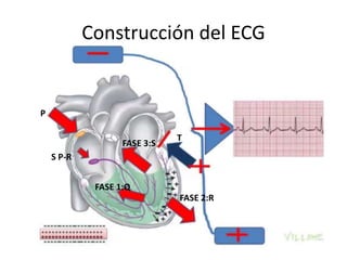 Construcción del ECG
P
S P-R
FASE 1:Q
FASE 2:R
FASE 3:S
T
 