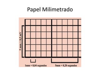 Papel Milimetrado
 