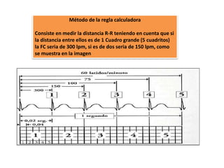 Método de la regla calculadora
Consiste en medir la distancia R-R teniendo en cuenta que si
la distancia entre ellos es de 1 Cuadro grande (5 cuadritos)
la FC seria de 300 lpm, si es de dos seria de 150 lpm, como
se muestra en la imagen
 