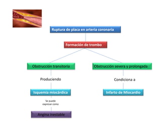 Ruptura de placa en arteria coronaria
Formación de trombo
Angina inestable
Obstrucción transitoria
Isquemia miocárdica
Obstrucción severa y prolongada
Infarto de Miocardio
Produciendo
Se puede
expresar como
Condiciona a
 