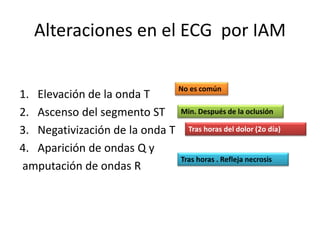 Alteraciones en el ECG por IAM
1. Elevación de la onda T
2. Ascenso del segmento ST
3. Negativización de la onda T
4. Aparición de ondas Q y
amputación de ondas R
No es común
Min. Después de la oclusión
Tras horas del dolor (2o día)
Tras horas . Refleja necrosis
 