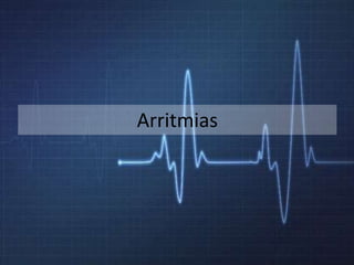 Arritmias
 